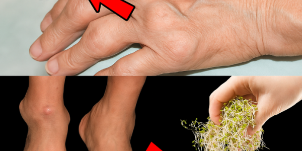 How Bean Sprouts May Support Kidney and Joint Health Naturally