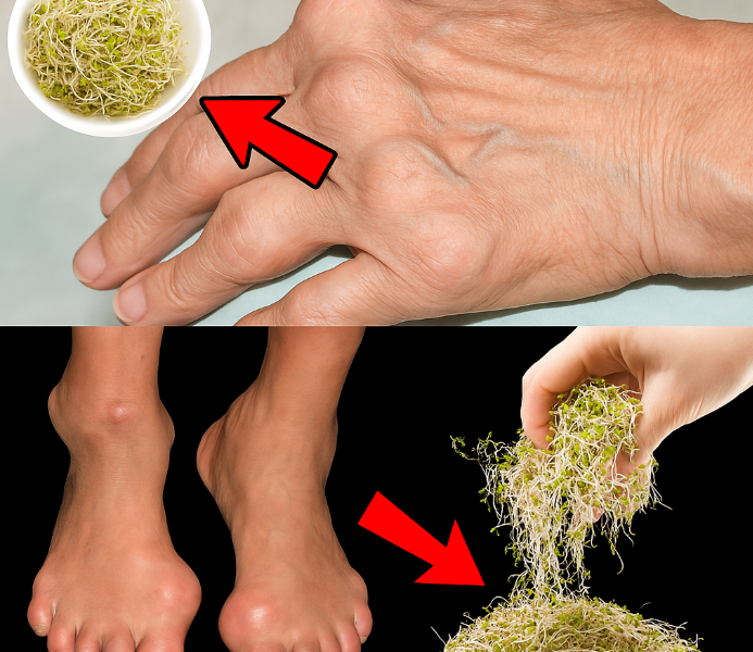 How Bean Sprouts May Support Kidney and Joint Health Naturally How Bean Sprouts May Support Kidney and Joint Health Naturally