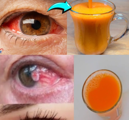 At 65, I Faced Vision Loss—But a Simple Daily Drink Helped Me See More Clearly At 65, I Faced Vision Loss—But a Simple Daily Drink Helped Me See More Clearly