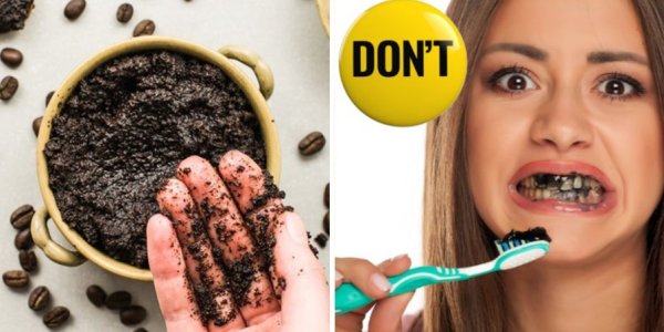 Natural Teeth Whitening at Home: A Safer, Simpler Way to Brighten Your Smile