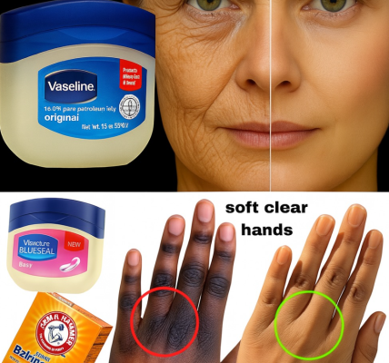 Can Vaseline Smooth Wrinkles and Soften Skin Naturally? What You Need to Know Can Vaseline Smooth Wrinkles and Soften Skin Naturally? What You Need to Know