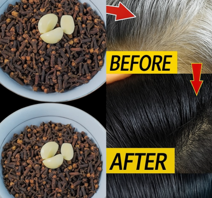 The Natural Secret to Darker, Healthier Hair with Garlic and Cloves The Natural Secret to Darker, Healthier Hair with Garlic and Cloves