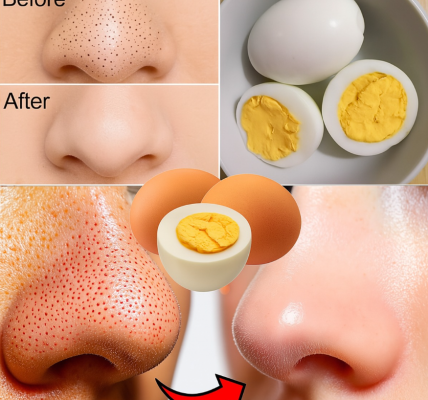 Say Goodbye to Blackheads with Just One Egg – Here’s How Say Goodbye to Blackheads with Just One Egg – Here’s How