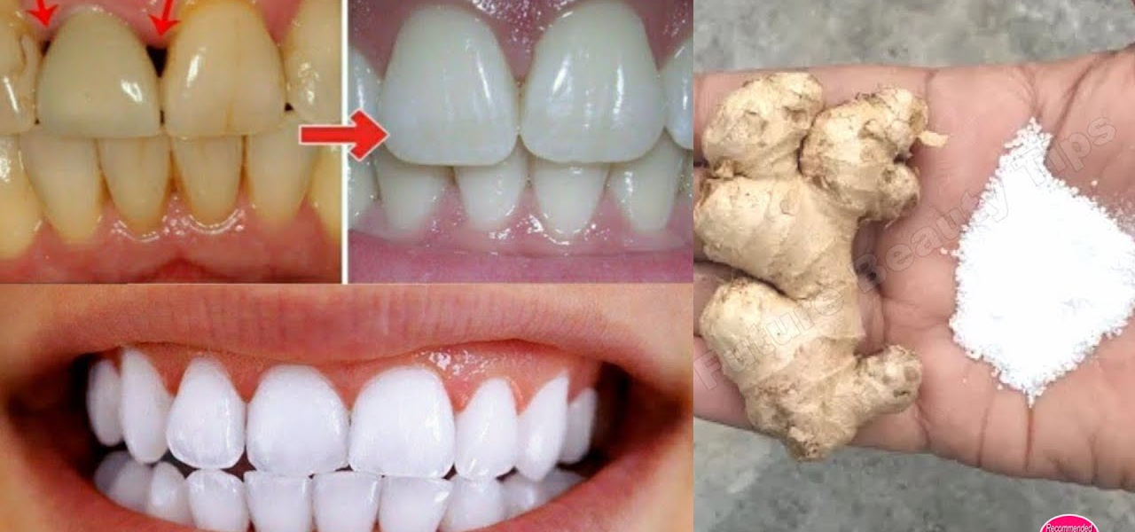 Unlock a Brighter Smile Naturally: The Ginger and Salt Whitening Secret Unlock a Brighter Smile Naturally: The Ginger and Salt Whitening Secret