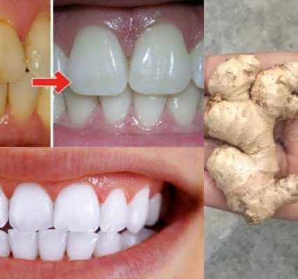 Unlock a Brighter Smile Naturally: The Ginger and Salt Whitening Secret Unlock a Brighter Smile Naturally: The Ginger and Salt Whitening Secret