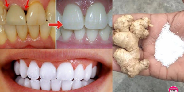 Unlock a Brighter Smile Naturally: The Ginger and Salt Whitening Secret
