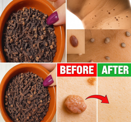 Erase Skin Tags and Warts Naturally with This Clove Remedy That’s Been Hidden in Plain Sight