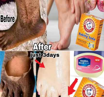 How to Naturally Lighten Dark Inner Thighs, Underarms, Hands, and Legs with This Simple DIY Remedy How to Naturally Lighten Dark Inner Thighs, Underarms, Hands, and Legs with This Simple DIY Remedy