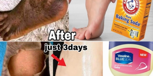 How to Naturally Lighten Dark Inner Thighs, Underarms, Hands, and Legs with This Simple DIY Remedy