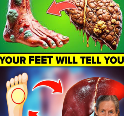 17 Gentle Signs Your Liver Might Need Some Extra Care 17 Gentle Signs Your Liver Might Need Some Extra Care