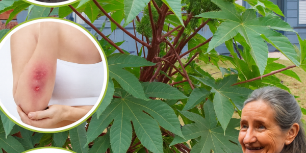 15 Remarkable Benefits of Castor Leaves for Men and Women Over 30