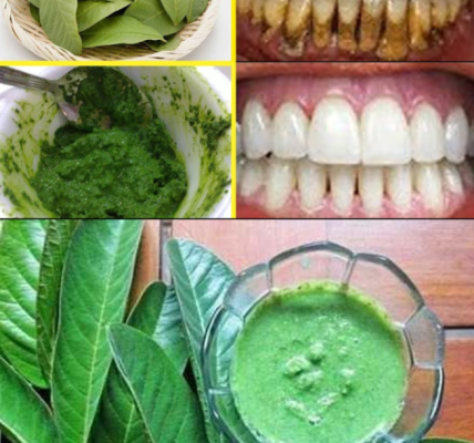 Guava Leaves for a Brighter Smile: A 70-Year-Old Grandma’s Natural Secret Guava Leaves for a Brighter Smile: A 70-Year-Old Grandma’s Natural Secret