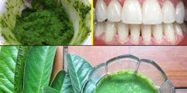 Guava Leaves for a Brighter Smile: A 70-Year-Old Grandma’s Natural Secret
