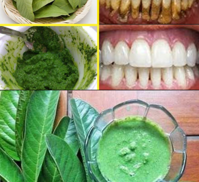Guava Leaves for a Brighter Smile: A 70-Year-Old Grandma’s Natural Secret Guava Leaves for a Brighter Smile: A 70-Year-Old Grandma’s Natural Secret