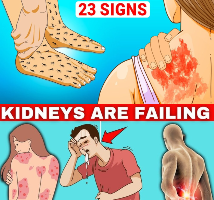 23 Strange Signs of Kidney Disease Most People Miss — Until It’s Too Late 23 Strange Signs of Kidney Disease Most People Miss — Until It’s Too Late