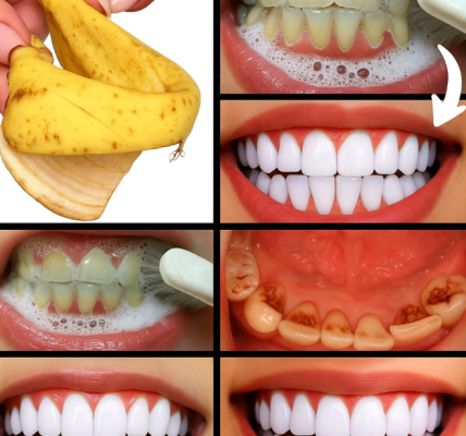Do Bananas Really Help Whiten Teeth? Here’s What You Need to Know Do Bananas Really Help Whiten Teeth? Here’s What You Need to Know