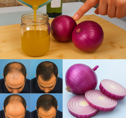 Why Onion for Hair? What the Research Says Why Onion for Hair? What the Research Says