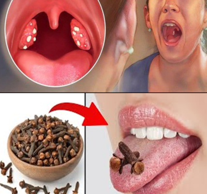 Cloves for Sore Throat Relief: A Natural Way to Soothe Inflammation and Support Healing Cloves for Sore Throat Relief: A Natural Way to Soothe Inflammation and Support Healing