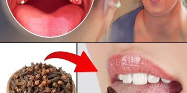 Cloves for Sore Throat Relief: A Natural Way to Soothe Inflammation and Support Healing