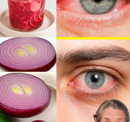 Can Onion Really Improve Your Eyesight in 5 Days? Hereās the Surprising Truth Can Onion Really Improve Your Eyesight in 5 Days? Hereās the Surprising Truth