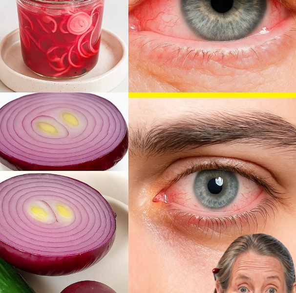 Can Onion Really Improve Your Eyesight in 5 Days? Here’s the Surprising Truth Can Onion Really Improve Your Eyesight in 5 Days? Here’s the Surprising Truth