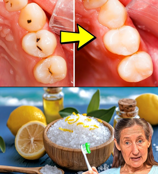 Natural Ways to Support Your Smile: 6 Gentle Tips to Care for Early Tooth Decay Natural Ways to Support Your Smile: 6 Gentle Tips to Care for Early Tooth Decay