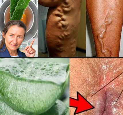 Discover the Natural Benefits of Aloe Vera for Your Health Discover the Natural Benefits of Aloe Vera for Your Health