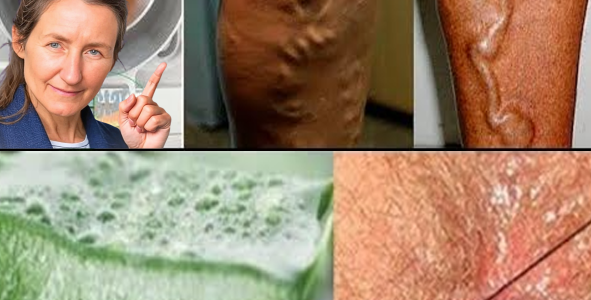 Discover the Natural Benefits of Aloe Vera for Your Health