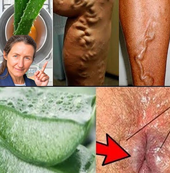 Discover the Natural Benefits of Aloe Vera for Your Health Discover the Natural Benefits of Aloe Vera for Your Health