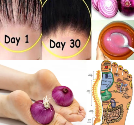 14 Natural Ways Onions May Support Your Health: A Simple Guide to Wellness from the Kitchen 14 Natural Ways Onions May Support Your Health: A Simple Guide to Wellness from the Kitchen