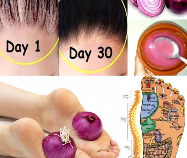 14 Natural Ways Onions May Support Your Health: A Simple Guide to Wellness from the Kitchen 14 Natural Ways Onions May Support Your Health: A Simple Guide to Wellness from the Kitchen