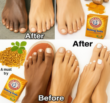 How I Naturally Transformed the Look of My Legs: Brighter, Smoother, More Youthful Skin at Home How I Naturally Transformed the Look of My Legs: Brighter, Smoother, More Youthful Skin at Home