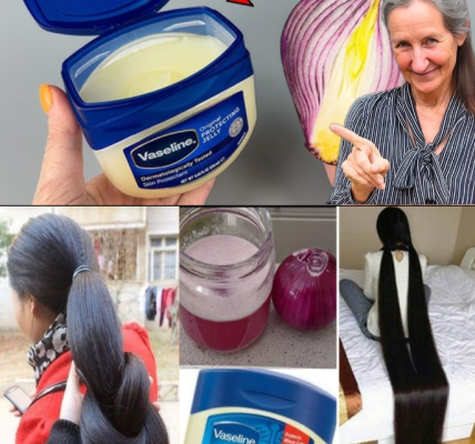 The Japanese Secret to Naturally Radiant Skin: How Onions Can Support a Youthful Glow—Even at 70 The Japanese Secret to Naturally Radiant Skin: How Onions Can Support a Youthful Glow—Even at 70