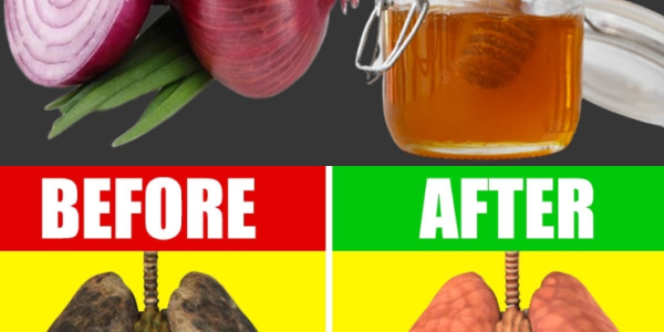 Breathe Easy Again: A Natural Way to Soothe Your Lungs with Onion and Honey