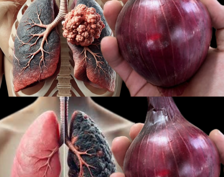 Clear Your Lungs and Stop Coughing in Just 3 Days with This Powerful Onion Remedy! Clear Your Lungs and Stop Coughing in Just 3 Days with This Powerful Onion Remedy!