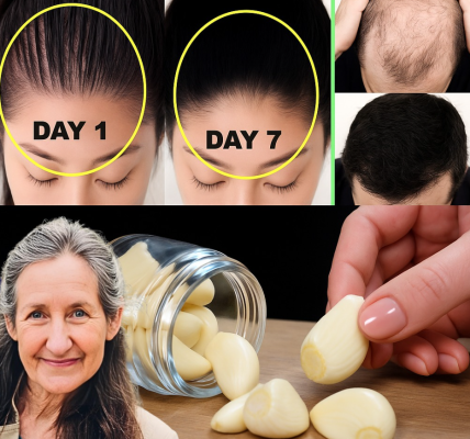 Hair Grows Like Crazy and Stops Falling Out ā The Best Natural Remedy with Just 3 Powerful Ingredients! Hair Grows Like Crazy and Stops Falling Out ā The Best Natural Remedy with Just 3 Powerful Ingredients!
