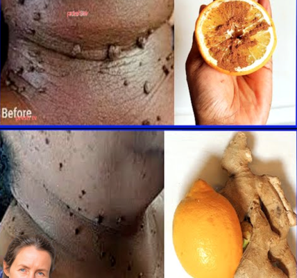 Lemon and Ginger: Simple Ways to Support Your Wellness and Skin Health Lemon and Ginger: Simple Ways to Support Your Wellness and Skin Health