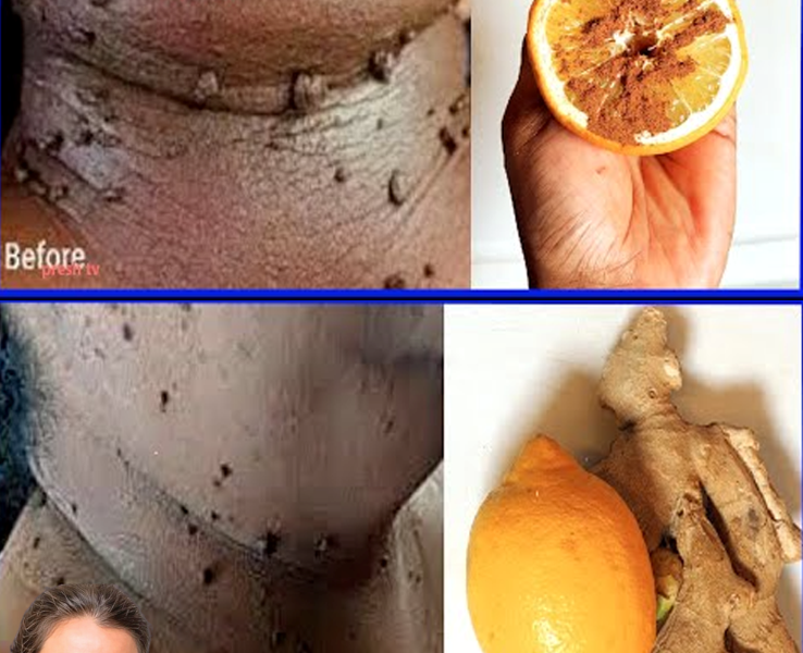 Lemon and Ginger: Simple Ways to Support Your Wellness and Skin Health Lemon and Ginger: Simple Ways to Support Your Wellness and Skin Health