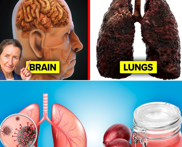 Breathe Easy Again: A Natural Way to Soothe Your Lungs with Onion and Honey