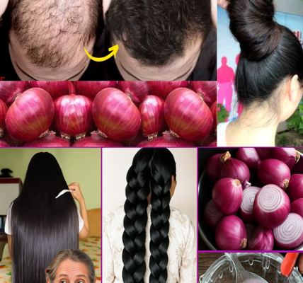 Boost Hair Growth Naturally with Onions Boost Hair Growth Naturally with Onions