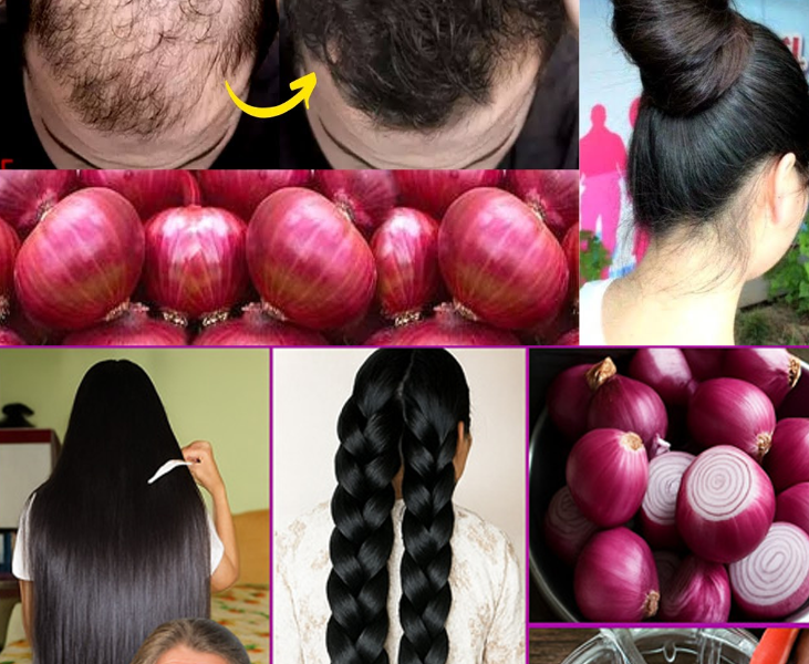 Boost Hair Growth Naturally with Onions Boost Hair Growth Naturally with Onions