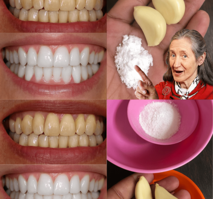 🦷 Whiten Your Smile in 2 Minutes: The Garlic & Salt Natural Teeth Brightener