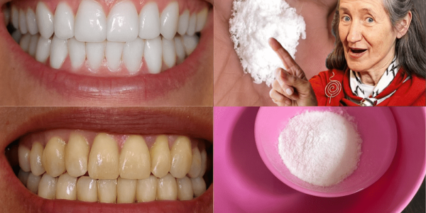 🦷 Whiten Your Smile in 2 Minutes: The Garlic & Salt Natural Teeth Brightener