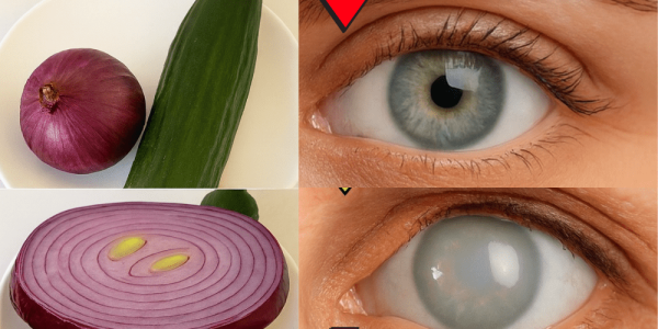 👁️ Can Onions Really Boost Your Vision in Just 5 Days? Uncover the Surprising Truth! 👁️ Can Onions Really Boost Your Vision in Just 5 Days? Uncover the Surprising Truth!