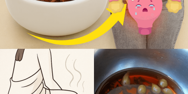 🌿 Discover the Healing Magic of Cloves: Simple Remedies to Transform Your Health