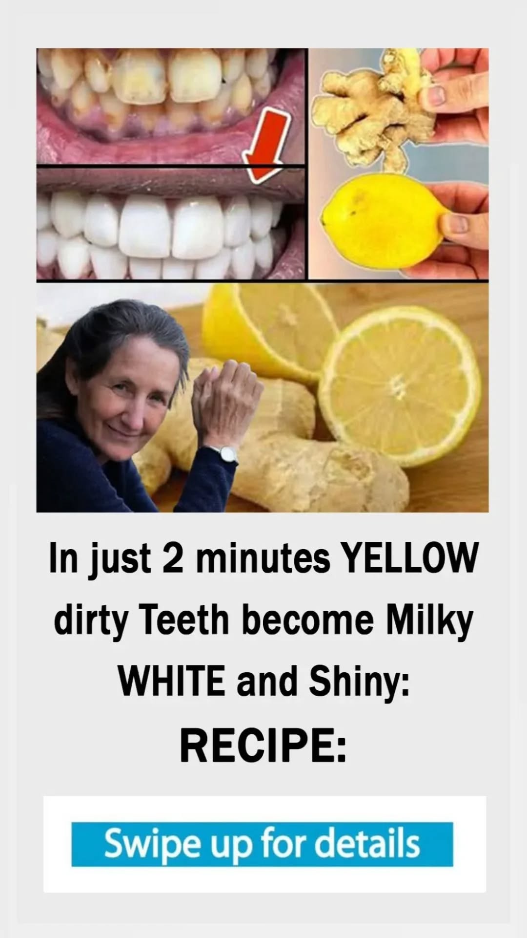 In 2 minutes yellow dirty Teeth become Milky white – recipe In 2 minutes yellow dirty Teeth become Milky white – recipe