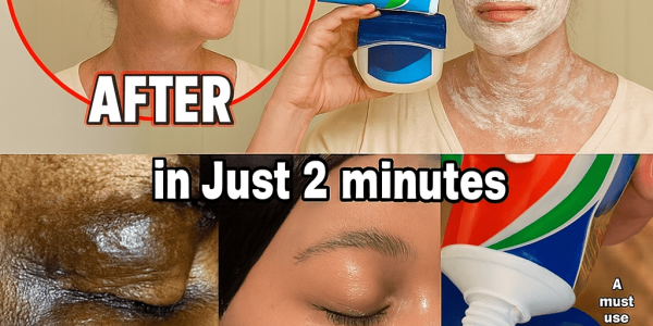 🌟 Toothpaste & Vaseline: The Viral Skincare Hack That Promises Radiant Skin 🌟 Toothpaste & Vaseline: The Viral Skincare Hack That Promises Radiant Skin