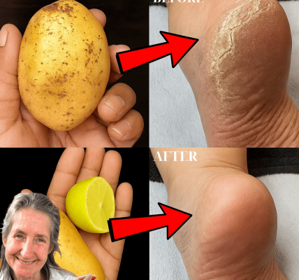 🦶 Transform Your Feet: The Potato and Lemon Secret to Silky, Crack-Free Heels 🦶 Transform Your Feet: The Potato and Lemon Secret to Silky, Crack-Free Heels