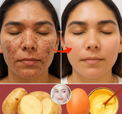 ✨ Fade Dark Spots Naturally: The Ultimate Potato & Egg Mask Guide for Radiant Skin ✨ Fade Dark Spots Naturally: The Ultimate Potato & Egg Mask Guide for Radiant Skin