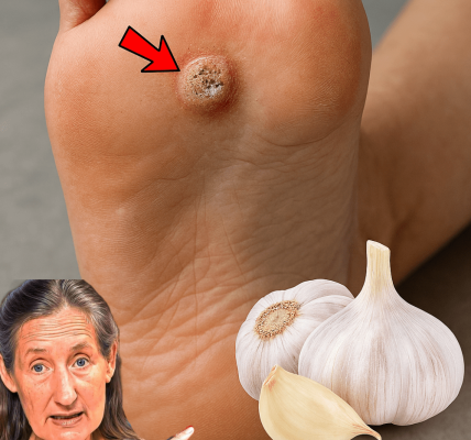 🌿 Zap Plantar Warts for Good: Irresistible Garlic Remedies to Reclaim Your Feet 🌿 Zap Plantar Warts for Good: Irresistible Garlic Remedies to Reclaim Your Feet
